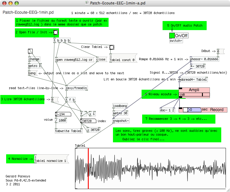 Patch-Ecoute-EEG-1min-a