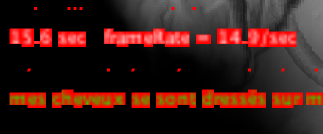 PbTexte2